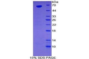 SDS-PAGE analysis of Human Sulfatase 1 Protein. (SULF1 Protein)