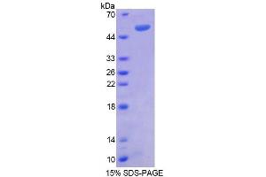 SDS-PAGE (SDS) image for Regulator of G-Protein Signaling 1 (RGS1) (AA 1-209) protein (His tag,GST tag) (ABIN4989979) (RGS1 Protein (AA 1-209) (His tag,GST tag))