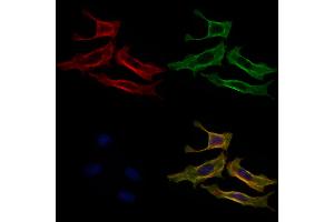 ABIN6260174 and ABIN6279185 staining 3 by IF/ICC.