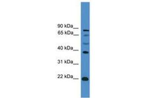 Image no. 1 for anti-Achaete-Scute Complex Homolog 2 (ASCL2) (AA 121-170) antibody (ABIN6745359) (ASCL2 Antikörper  (AA 121-170))