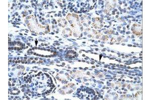 Image no. 2 for anti-V-Ets erythroblastosis Virus E26 Oncogene Homolog 1 (Avian) (ETS1) (AA 52-101) antibody (ABIN202532) (ETS1 Antikörper  (AA 52-101))