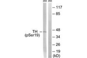 Western blot analysis of extracts from 293 cells treated with Insulin 0. (Tyrosine Hydroxylase Antikörper  (pSer18))