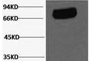 Western Blot analysis of Human serum using Transferrin Monoclonal Antibody at dilution of 1:2000. (Transferrin Antikörper)