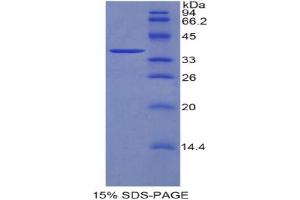 SDS-PAGE analysis of Mouse DKK4 Protein. (DKK4 Protein)