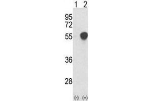 Western blot analysis of PHGDH antibody and 293 cell lysate either nontransfected (Lane 1) or transiently transfected with the PHGDH gene (2).