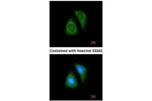 ICC/IF Image Immunofluorescence analysis of methanol-fixed HeLa, using SHP1, antibody at 1:200 dilution. (SHP1 Antikörper  (Center))