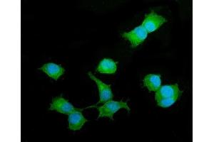 IF analysis of Beta 2 Microglobulin/B2m using anti-Beta 2 Microglobulin/B2m antibody (ABIN7600594). (beta-2 Microglobulin Antikörper  (AA 21-119))