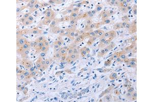 Immunohistochemistry (IHC) image for anti-Fibroblast Growth Factor 4 (FGF4) antibody (ABIN2825910) (FGF4 Antikörper)