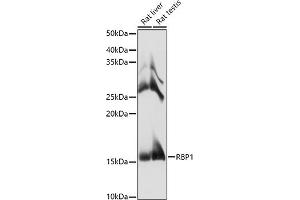 Western blot analysis of extracts of various cell lines, using RBP1 antibody (ABIN6129597, ABIN6146795, ABIN6146796 and ABIN6214136) at 1:1000 dilution. (RBP1 Antikörper  (AA 63-197))