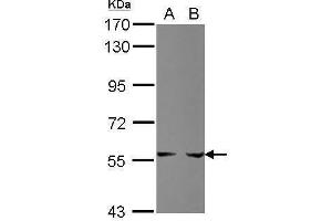 WB Image Sample (30 ug of whole cell lysate) A: HepG2 B: HCT116 7. (PPAT Antikörper)