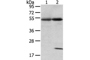Gel: 8 % SDS-PAGE, Lysate: 80 μg, Lane 1-2: Human lung cancer and placenta tissue, Primary antibody: ABIN7192580(SNTA1 Antibody) at dilution 1/200 dilution, Secondary antibody: Goat anti rabbit IgG at 1/8000 dilution, Exposure time: 1 minute