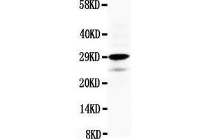Anti-Calretinin antibody, Western blotting WB: HELA Cell Lysate