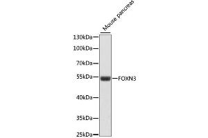 Western blot analysis of extracts of mouse pancreas, using FOXN3 antibody (ABIN6290407) at 1:1000 dilution. (FOXN3 Antikörper)