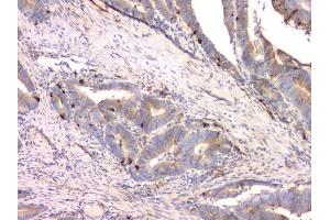 IHC analysis of Cystatin C/CST3 using anti-Cystatin C/CST3 antibody (ABIN6719299). (CST3 Antikörper  (AA 31-146))
