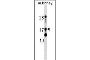 Western blot analysis in mouse kidney tissue lysates (35ug/lane). (DR1 Antikörper  (AA 83-112))