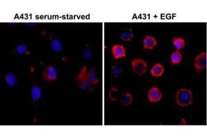 ICC test of serum-starved human A431 cells non-treated or treated with EGF, using the recombinant Phosphotyrosine antibody at 1:500 (red) and DAPI (blue).