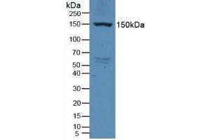 Detection of VEGFR2 in Rat Serum using Polyclonal Antibody to Vascular Endothelial Growth Factor Receptor 2 (VEGFR2) (VEGFR2/CD309 Antikörper  (AA 46-320))