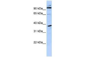 PHF11 antibody used at 0. (PHF11 Antikörper  (N-Term))
