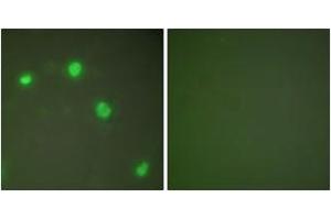 Immunofluorescence analysis of COS7 cells, using Ku70 Antibody. (XRCC6 Antikörper  (AA 560-609))