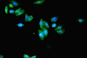 Immunofluorescent analysis of HepG2 cells using ABIN7157306 at dilution of 1:100 and Alexa Fluor 488-congugated AffiniPure Goat Anti-Rabbit IgG(H+L) (KLHDC5 Antikörper  (AA 1-410))