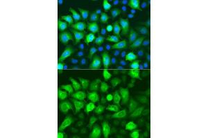 Immunofluorescence analysis of A549 cells using RRM2 antibody. (RRM2 Antikörper  (AA 1-389))