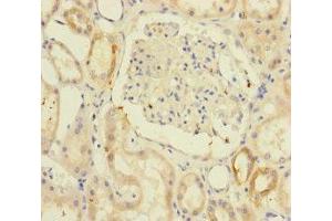 Immunohistochemistry (IHC) image for anti-Resistance To Inhibitors of Cholinesterase 8 Homolog A (C. Elegans) (RIC8A) (AA 362-531) antibody (ABIN7171203)