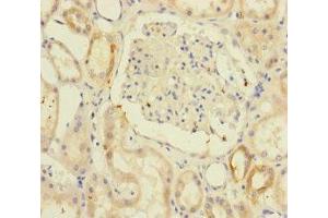 Immunohistochemistry of paraffin-embedded human kidney tissue using ABIN7171203 at dilution of 1:100 (RIC8A Antikörper  (AA 362-531))