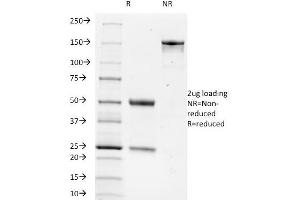 SDS-PAGE Analysis Purified TRIM29 Monoclonal Antibody (TRIM29/1042). (TRIM29 Antikörper  (AA 1-200))