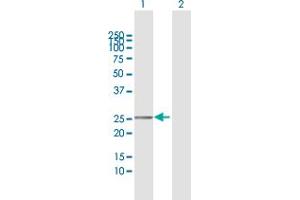 Western Blot analysis of TMEM177 expression in transfected 293T cell line by TMEM177 MaxPab polyclonal antibody. (TMEM177 Antikörper  (AA 31-311))