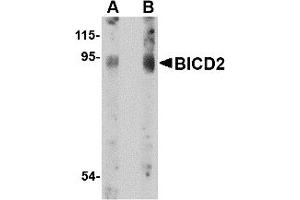 Western Blotting (WB) image for anti-Bicaudal D Homolog 2 (BICD2) (C-Term) antibody (ABIN1030295) (BICD2 Antikörper  (C-Term))