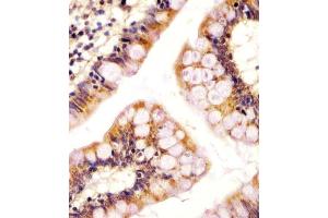 (ABIN655484 and ABIN2845005) staining RSBN1 in human colon tissue sections by Immunohistochemistry (IHC-P - paraformaldehyde-fixed, paraffin-embedded sections). (RSBN1 Antikörper  (N-Term))