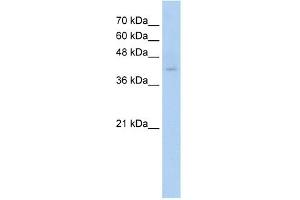 WB Suggested Anti-C9orf127 Antibody Titration:  0. (TMEM8B Antikörper  (N-Term))