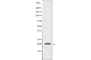Western blot analysis of extracts from A549 cells, using ATP5L2 antibody. (ATP5L2 Antikörper  (C-Term))