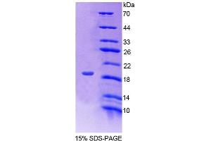 SDS-PAGE analysis of Human FKBP2 Protein.