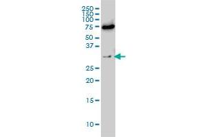EXOSC8 monoclonal antibody (M01), clone 1G5 Western Blot analysis of EXOSC8 expression in Hela S3 NE . (EXOSC8 Antikörper  (AA 1-276))