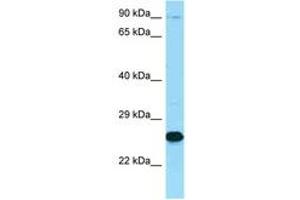 Image no. 1 for anti-Membrane Metallo-Endopeptidase (MME) (C-Term) antibody (ABIN6748399)