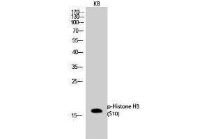 Western Blotting (WB) image for anti-Histone 3 (H3) (pSer10) antibody (ABIN3179450) (Histone 3 Antikörper  (pSer10))