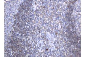 Image no. 4 for anti-Mast/stem Cell Growth Factor Receptor (KIT) (AA 546-976) antibody (ABIN1491585)