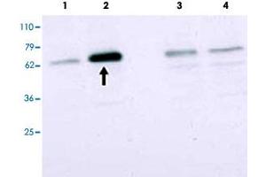 Western blot using SMAD2 polyclonal antibody  to detect over-expressed SMAD2 in COS cells (arrow). (SMAD2 Antikörper  (Internal Region))