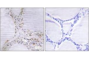 Immunohistochemistry analysis of paraffin-embedded human thyroid gland tissue, using BMX Antibody. (BMX Antikörper  (AA 11-60))