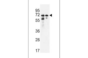 PNPLA8 Antibody (N-term) (ABIN650904 and ABIN2839989) western blot analysis in Hela,K562 cell line lysates (35 μg/lane).