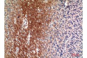 Immunohistochemistry (IHC) analysis of paraffin-embedded Human Brain, antibody was diluted at 1:100. (Complement C4A/C4B (Internal Region) Antikörper)