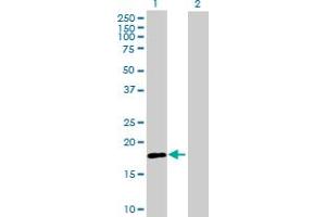 Western Blot analysis of RNF170 expression in transfected 293T cell line by RNF170 MaxPab polyclonal antibody. (RNF170 Antikörper  (AA 1-200))