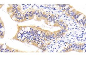 Detection of RBP2 in Human Small intestine Tissue using Monoclonal Antibody to Retinol Binding Protein 2, Cellular (RBP2) (RBP2 Antikörper  (AA 1-134))