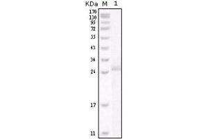 Western Blotting (WB) image for anti-Receptor tyrosine-protein kinase erbB-2 (ErbB2/Her2) antibody (ABIN1845273) (ErbB2/Her2 Antikörper)