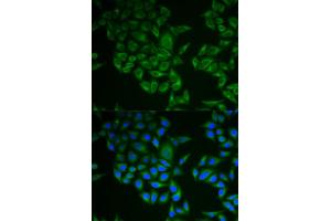 Immunofluorescence analysis of A549 cells using CD247 antibody (ABIN5971089). (CD247 Antikörper)