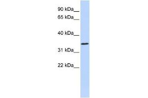 ZNF660 antibody used at 0. (ZNF660 Antikörper  (N-Term))