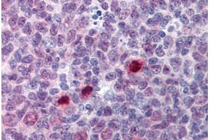 Human Tonsil, Mitotic Figures: Formalin-Fixed, Paraffin-Embedded (FFPE) (Separase Antikörper  (AA 586-702))