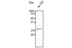 Anti-Rab5c Ab at 1/500 dilution, lysates at 100 µg per Iane, rabbit polyclonal to goat lgG (HRP) at 1/10,000 dilution, (Rab5c Antikörper  (C-Term))
