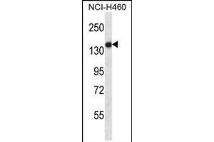 TLR8 Antibody (Center) (ABIN657933 and ABIN2846877) western blot analysis in NCI- cell line lysates (35 μg/lane).